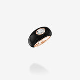 Black Hole Ring